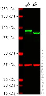 Anti-beta Catenin antibody [E247] - ChIP Grade(AB32572)