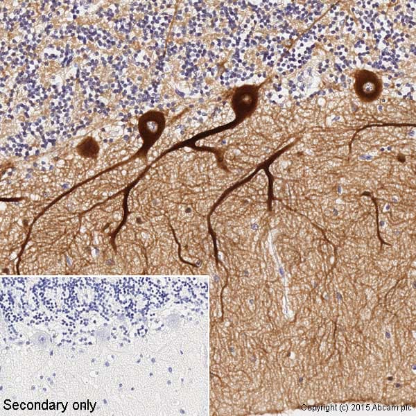 Anti-beta III Tubulin antibody [TU-20] - Neuronal Marker(ab7751)