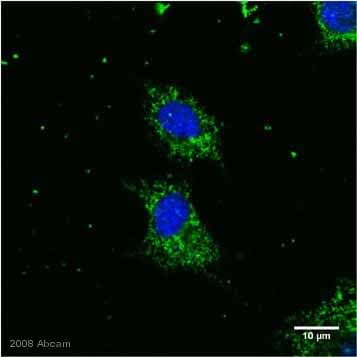 Anti-SOD2/MnSOD antibody(AB13534)