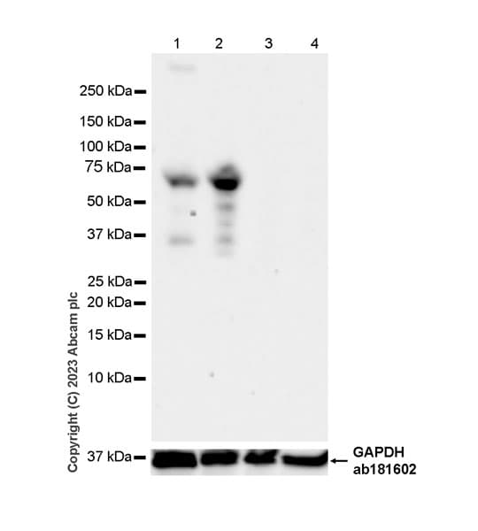 Loxl1 Antibody Epr28297 2 Ab313585  Western Blot Img418211