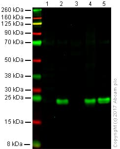 Anti-TAGLN/Transgelin antibody [EPR21206](AB213273)