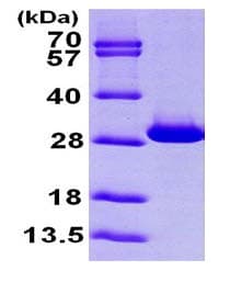 Recombinant Human Triosephosphate isomerase protein(AB100826)