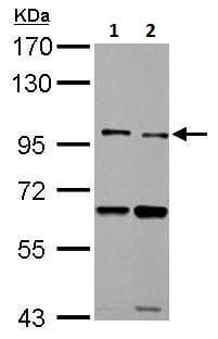 Tlr5 Antibody N Terminal Ab228493  Western Blot Img87862