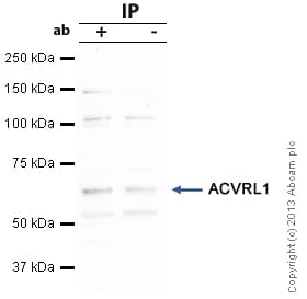 Anti-ALK-1 antibody(AB68703)