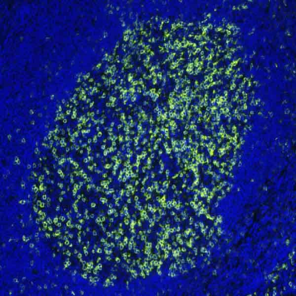 Anti-PD1 antibody [EPR4877(2)] - BSA and Azide free(AB186928)