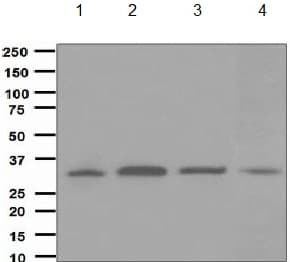 Cyb5r3 Antibody Epr3868 Ab133247  Western Blot Img7865