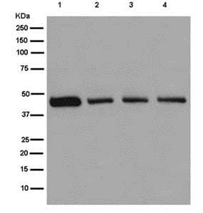 Nadk2 Antibody Epr13170 Ab181028  Western Blot Img4339
