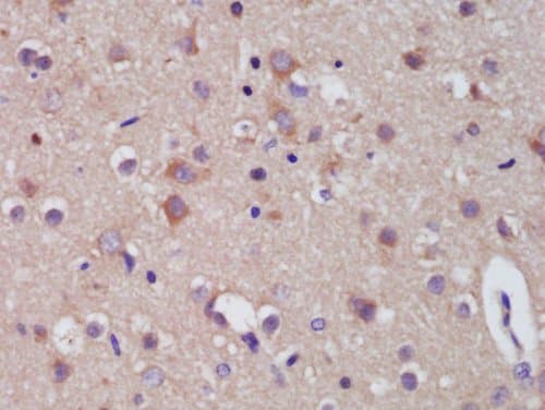 Prodynorphin Antibody Ab217160  Immunohistochemistry Formalin Pfa Fixed Paraffin Embedded Sections Img109954