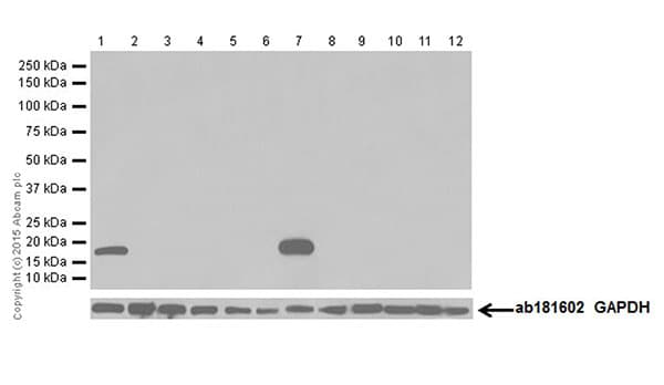 Olfactory Marker Protein Omp Antibody Epr19190 Bsa And Azide Free Ab250712  Western Blot Img7786