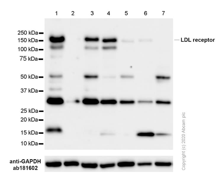 Anti-LDL Receptor antibody [EP1553Y](AB52818)