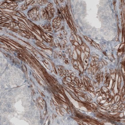 Anti-Laminin alpha 4/LAMA4 antibody [CL3185](AB242359)