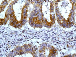 Jak1 Phospho Y1034 Y1035 Antibody Epr18992 Ab138005  Immunohistochemistry Formalin Pfa Fixed Paraffin Embedded Sections Img124712