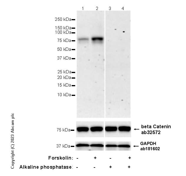 Anti-beta Catenin antibody [E247] - ChIP Grade(AB32572)