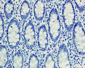Anti-SNAP25 antibody [EP3274] - BSA and Azide free(AB226046)