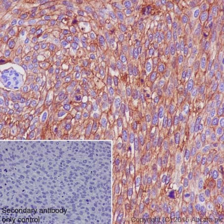 Anti-Glucose Transporter GLUT1 antibody [EPR3915] - BSA and Azide free(AB252403)