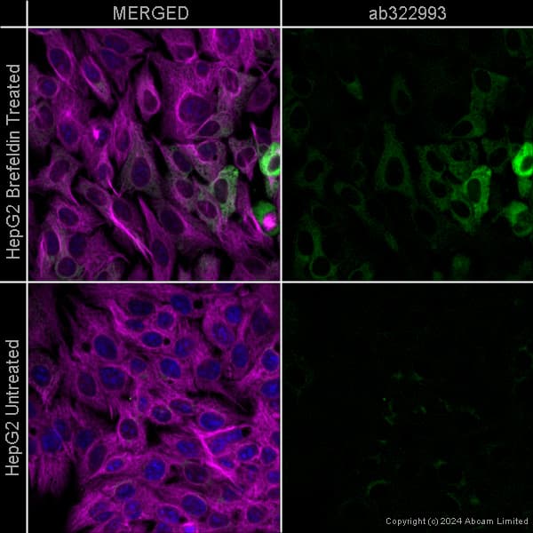 Alexa Fluor 594 Alpha Tubulin Antibody Ep1332y Microtubule Marker Ab202272  Immunocytochemistry Immunofluorescence Img440913