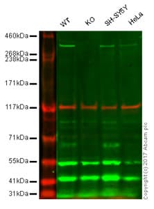 Anti-Huntingtin antibody [EPR5526](AB109115)