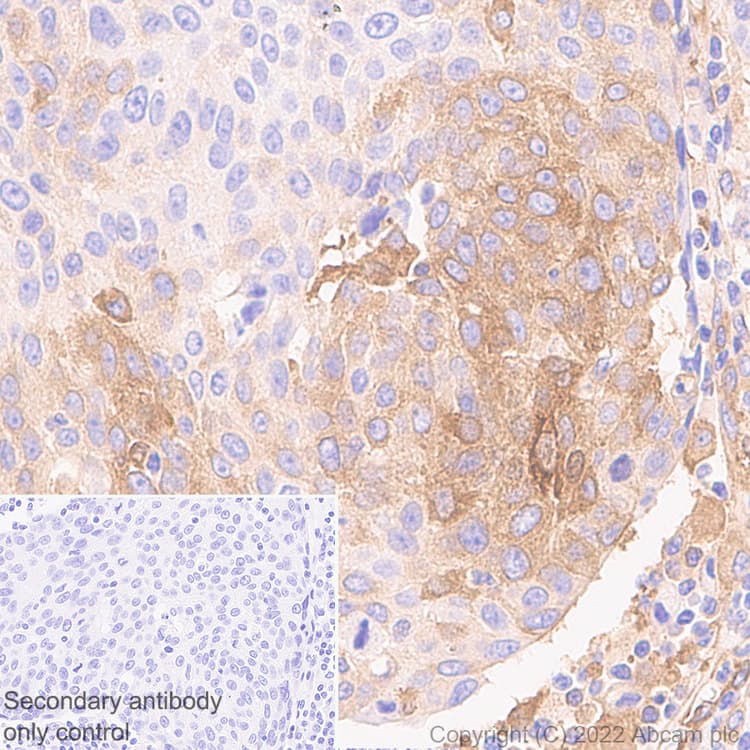 Ifit1 Antibody Epr27276 63 Bsa And Azide Free Ab305302  Immunohistochemistry Formalin Pfa Fixed Paraffin Embedded Sections Img405045