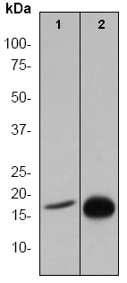 Anti-Histone H3 (acetyl K14) antibody [EP964Y] - ChIP Grade(AB52946)