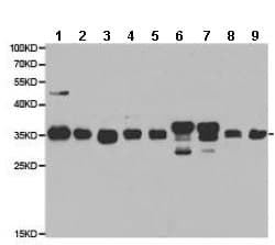 Anti-CBR1 antibody(AB186825)