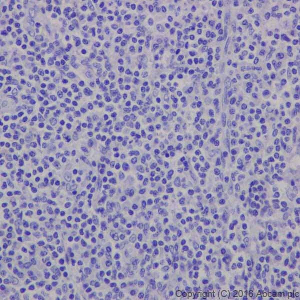 Anti-MAP2 antibody [EPR19691](AB183830)