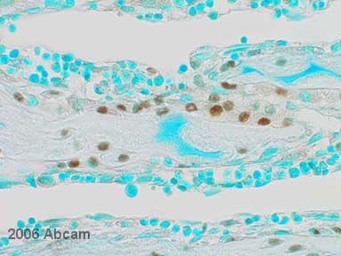 Anti-Sp7 / Osterix antibody(AB22552)