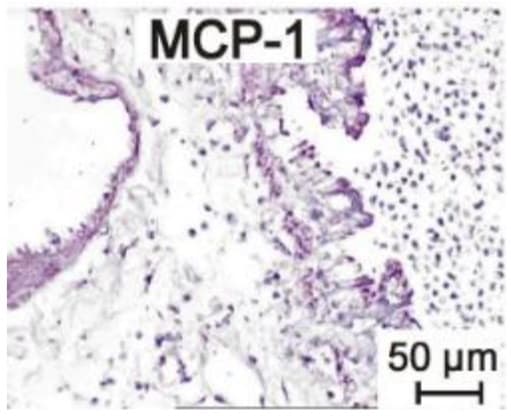 Anti-MCP1 antibody(AB7202)