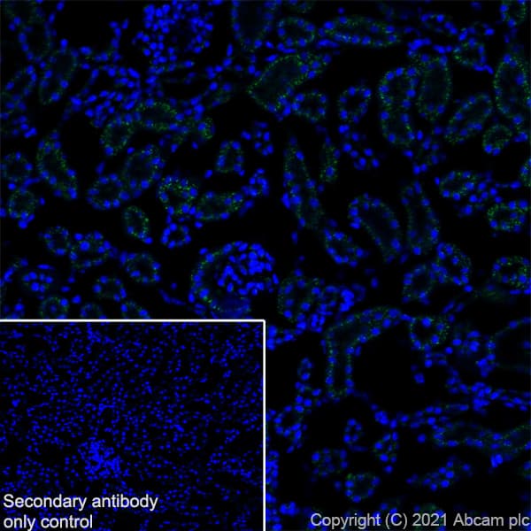 Anti-TM9SF2 antibody [EPR24416-17] - BSA and Azide free(AB281838)