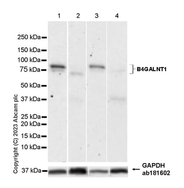 B4galnt1 Antibody Epr28064 64 Ab314130  Western Blot Img419963