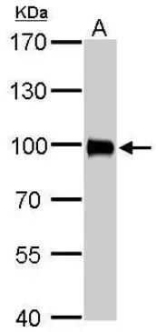 Anti-Villin antibody(AB97512)