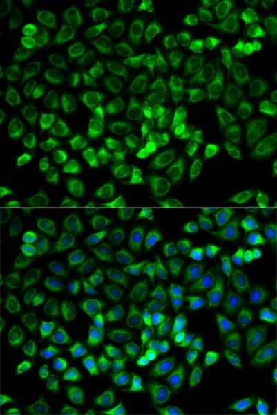 Mast Cell Tryptase Antibody Ab196772  Immunocytochemistry Immunofluorescence Img118662