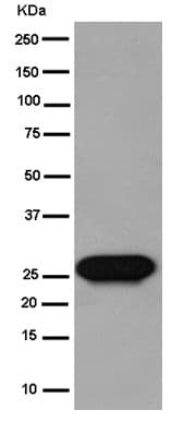 Claudin 17 Antibody Epr15483 Ab186744  Western Blot Img61885