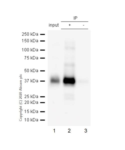 Anti-CD32B (phospho Y292) antibody [EP926Y](AB68423)