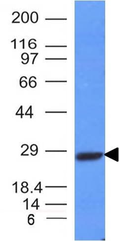 Anti-Kappa light chain antibody [HP6053-L1C1](AB200546)