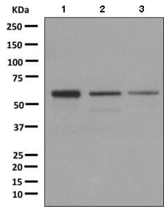 Anti-DKC1/Dyskerin antibody [EPR10399](AB156877)