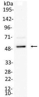 Irf8 Antibody Ab168808  Immunoprecipitation Img98555