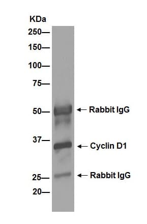 Anti-Cyclin D1 antibody [EPR2241] - C-terminal(AB134175)