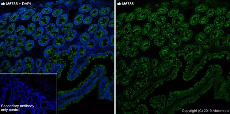 Anti-TOMM20 antibody [EPR15581-54] - Mitochondrial Marker(AB186735)