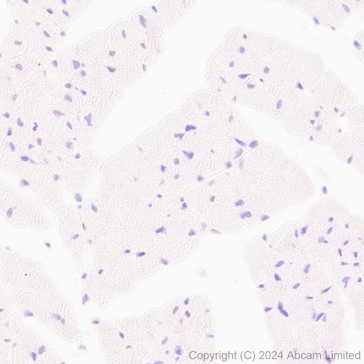 Anti-TBR2 / Eomes antibody [RM2055](AB319166)