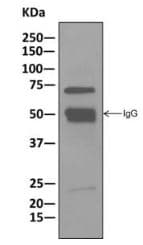 Asah2b Antibody Epr10539 Bsa And Azide Free Ab249617  Immunoprecipitation Img28508