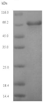 Recombinant EBV gp340/220 Envelope Protein (Tagged)(ab237750)