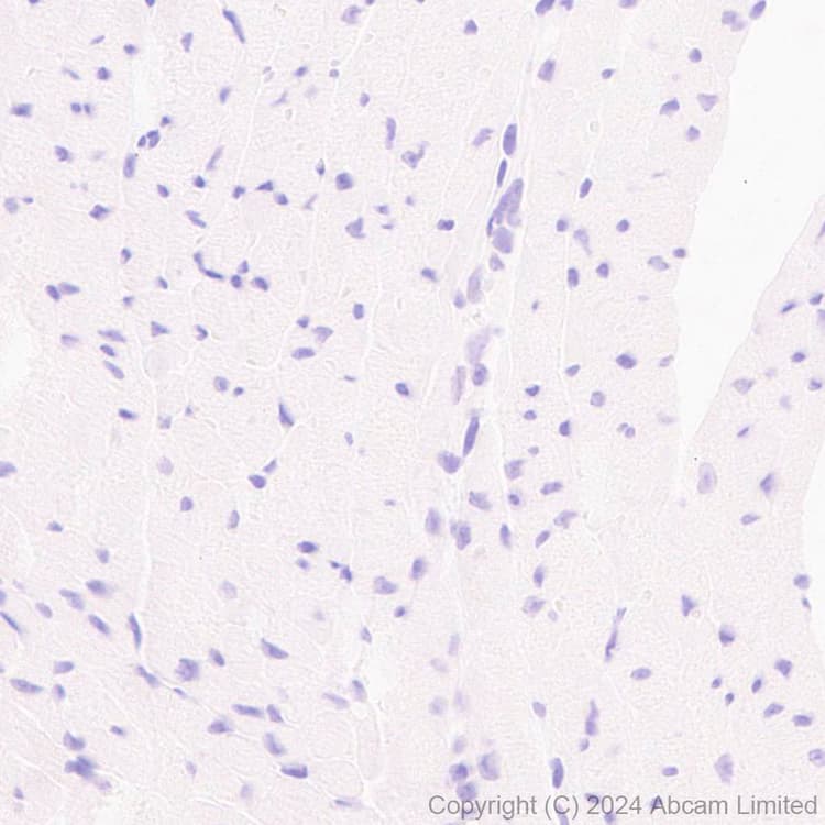 Anti-TBR2 / Eomes antibody [RM2055](AB319166)
