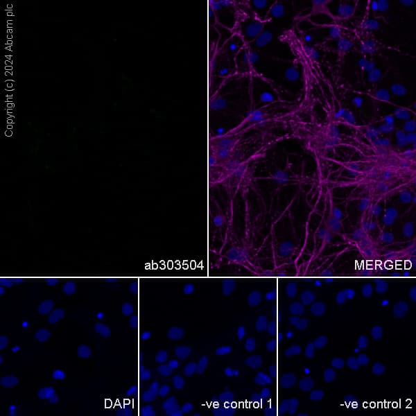 Anti-ABCA4 antibody [EPR26543-66](AB303504)