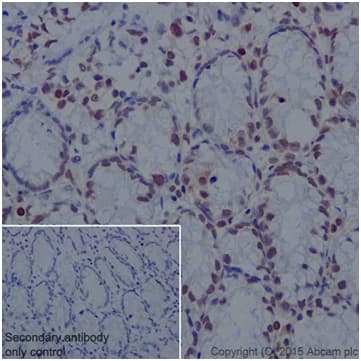 Anti-Histone H2A antibody [EPR17470] - ChIP Grade(AB177308)