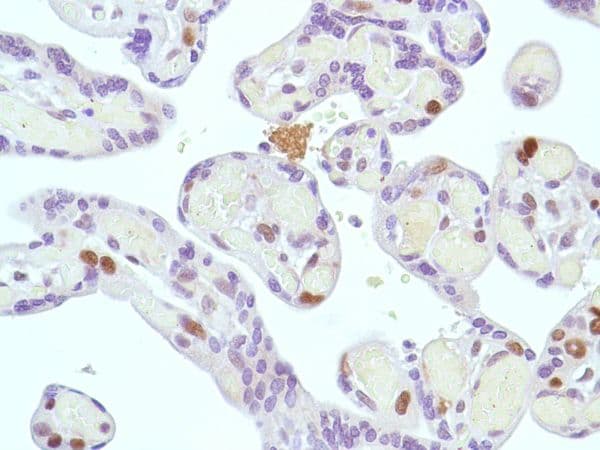 Anti-MSH2 antibody [SP46](AB231437)