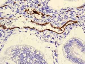 Anti-Claudin 5 antibody [EPR7583](AB131259)