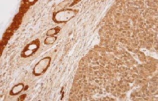 Anti-14-3-3 sigma/SFN antibody(AB151504)