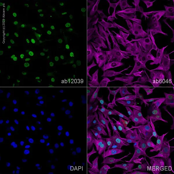 Goat Anti-Rabbit IgG H&L (Alexa Fluor® 594)(AB150080)