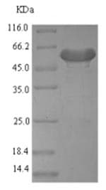 Recombinant Mouse SCDGFB/PDGF-D protein (Tagged)(ab226223)