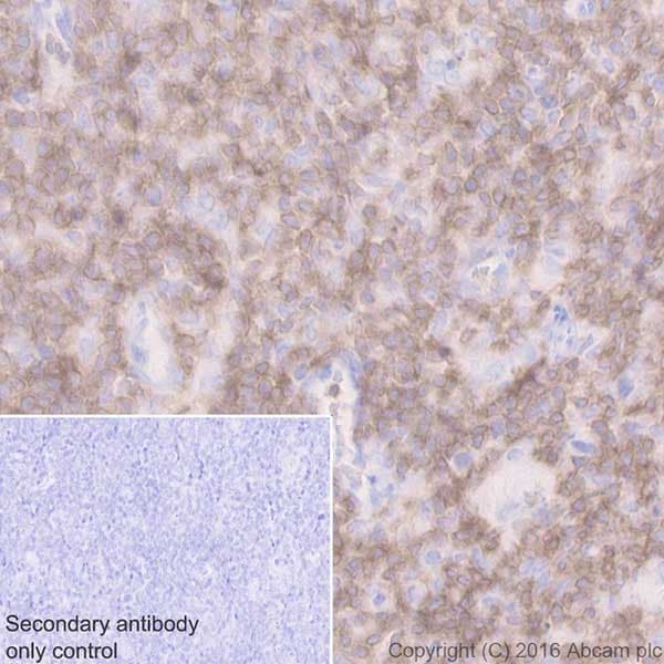 Cd3d Antibody Epr20544 Bsa And Azide Free Ab229280  Immunohistochemistry Formalin Pfa Fixed Paraffin Embedded Sections Img34526